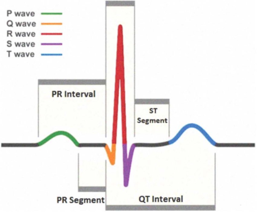 The PQRST complex. Image reproduced from [3] .